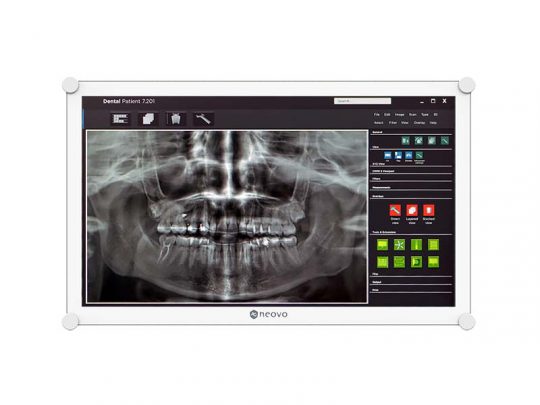 Dental X-ray image on computer screen showing teeth and jaw structure, with digital control buttons and menu options visible on the right side—ideal for dental imaging and patient diagnosis.